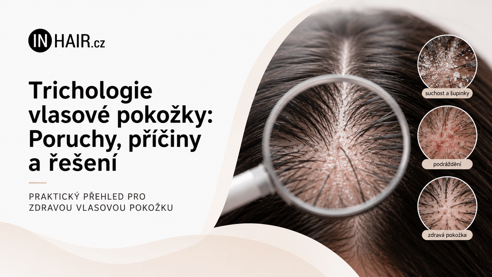 Trichologie vlasové pokožky: Poruchy, příčiny a řešení
