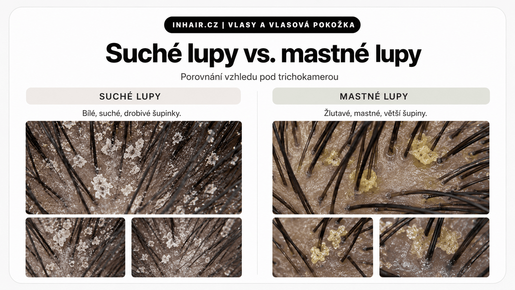 Suché vs. mastné lupy