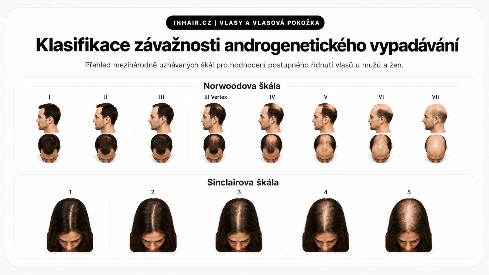 Norwood a Sinclair škála